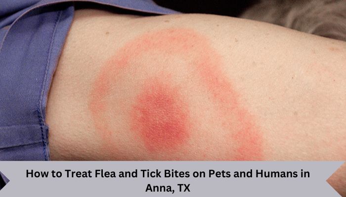 How to Treat Flea and Tick Bites on Pets and Humans in Anna, TX